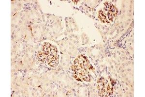IHC-P: ACTH antibody testing of rat kidney tissue (ACTH anticorps  (Middle Region))