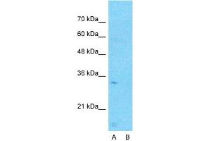 Host:  Rabbit  Target Name:  CCDC90A  Sample Type:  Human Fetal Lung  Lane A:  Primary Antibody  Lane B:  Primary Antibody + Blocking Peptide  Primary Antibody Concentration:  1ug/ml  Peptide Concentration:  5ug/ml  Lysate Quantity:  25ug/lane/lane  Gel Concentration:  0. (CCDC90A anticorps  (Middle Region))