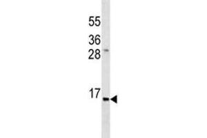 Anti-Insulin antibody western blot analysis in ZR-75-1 lysate.