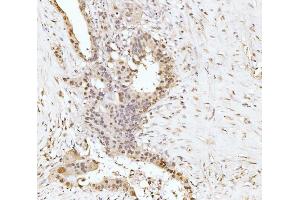 IHC analysis of RRP4/EXOSC2 using anti-RRP4/EXOSC2 antibody (ABIN7602188). (EXOSC2 anticorps  (AA 62-293))