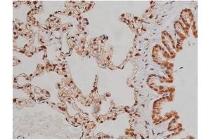 ABIN6267336 at 1/200 staining Rat lung tissue sections by IHC-P.