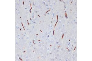 Immunohistochemistry of paraffin-embedded mouse brain using  antibody (ABIN6129926, ABIN6136997, ABIN6136998 and ABIN6218500) at dilution of 1:100 (40x lens). (APOA1 anticorps  (AA 25-267))