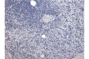 anti-Prolyl 4-Hydroxylase, alpha Polypeptide I (P4HA1) (Internal Region) antibody