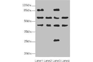 Western blot All lanes: FLVCR2 antibody at 0. (FLVCR2 anticorps  (AA 1-100))