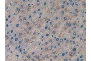 DAB staining on IHC-P; Samples: Rat Liver Tissue (FLIP anticorps  (AA 43-281))