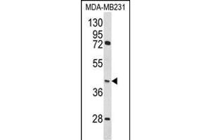 Western blot analysis of HOMER3 Antibody (Center) (ABIN652274 and ABIN2841157) in MDA-M cell line lysates (35 μg/lane). (HOMER3 anticorps  (AA 281-308))