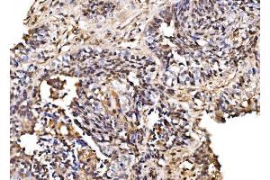 IHC analysis of PSMD8 using anti-PSMD8 antibody (ABIN7602571).