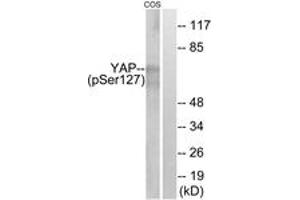 Western blot analysis of extracts from COS7 cells treated with HU 2nM 24h, using YAP (Phospho-Ser127) Antibody. (YAP1 anticorps  (pSer127))