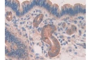 Detection of CARD9 in Mouse Uterus Tissue using Polyclonal Antibody to Caspase Recruitment Domain Family, Member 9 (CARD9)