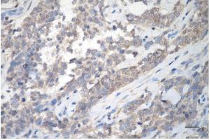 anti-Protein Kinase C, delta (PKCd) antibody