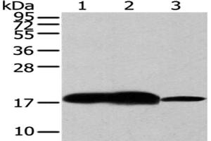 Gel: 12 % SDS-PAGE,Lysate: 40 μg,Lane 1-3: Human fetal brain tissue, Mouse brain tissue, Hela cells,Primary antibody: ABIN7193008(VAMP2 Antibody) at dilution 1/200 dilution,Secondary antibody: Goat anti rabbit IgG at 1/8000 dilution,Exposure time: 30 seconds