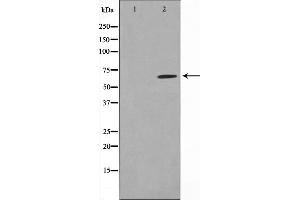 Western blot analysis on MDA-MB-435 cell lysate using PIAS1 Antibody,The lane on the left is treated with the antigen-specific peptide. (PIAS1 anticorps  (N-Term))