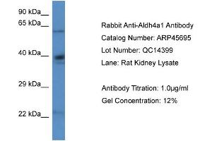 Western Blotting (WB) image for anti-Aldehyde Dehydrogenase 4 Family, Member A1 (ALDH4A1) (N-Term) antibody (ABIN2782322) (ALDH4A1 anticorps  (N-Term))