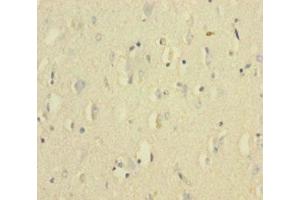 Immunohistochemistry of paraffin-embedded human brain tissue using ABIN7175654 at dilution of 1:100