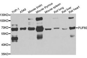 Western blot analysis of extracts of various cell lines, using PUF60 antibody (ABIN5974052) at 1/1000 dilution. (PUF60 anticorps)