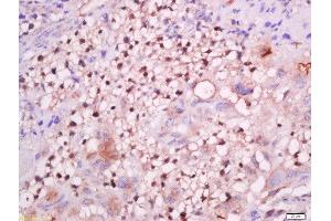 Formalin-fixed and paraffin embedded mouse placenta labeled with Anti-GCMA Polyclonal Antibody, Unconjugated  at 1:200 followed by conjugation to the secondary antibody and DAB staining.