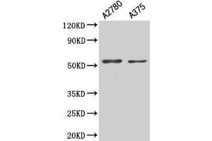 Western Blot Positive WB detected in: A2780 whole cell lysate, A375 whole cell lysate All lanes: PAX3 antibody at 5. (Paired Box 3 anticorps  (AA 90-184))