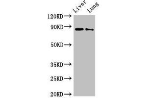 Western Blot Positive WB detected in: Rat liver tissue, Rat lung tissue All lanes: DENND1C antibody at 3 μg/mL Secondary Goat polyclonal to rabbit IgG at 1/50000 dilution Predicted band size: 88, 83 kDa Observed band size: 88 kDa (DENND1C anticorps  (AA 601-801))