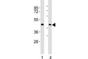 Western blot testing of CCR1 antibody at 1:2000 dilution.
