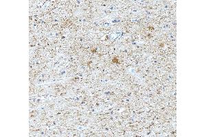 IHC analysis of Tenascin-R/TNR using anti-Tenascin-R/TNR antibody (ABIN4886752).