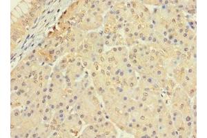 Immunohistochemistry of paraffin-embedded human pancreatic tissue using ABIN7147459 at dilution of 1:100 (CERKL anticorps  (AA 1-558))