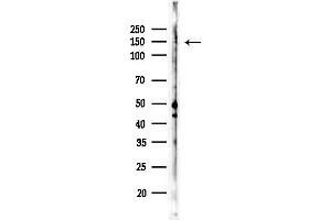 Western blot analysis of lysates from K562 cells(UV,30 min treatment), using Phospho-KDM3A (Tyr1114) Antibody at 1/1000 dilution.