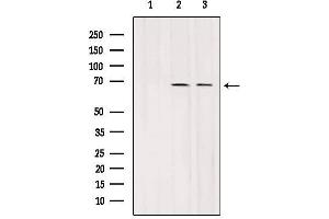 Western blot analysis of extracts from various samples, using SLC7A3 Antibody. (SLC7A3 anticorps  (Internal Region))