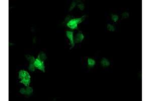 Anti-FBXO21 mouse monoclonal antibody (ABIN2455370) immunofluorescent staining of COS7 cells transiently transfected by pCMV6-ENTRY FBXO21 (RC223095). (FBXO21 anticorps)