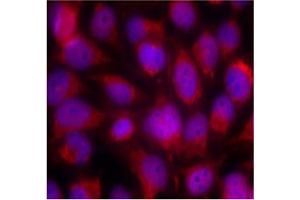 Image no. 3 for anti-Mitogen-Activated Protein Kinase Kinase Kinase 5 (MAP3K5) (Ser83) antibody (ABIN197310)