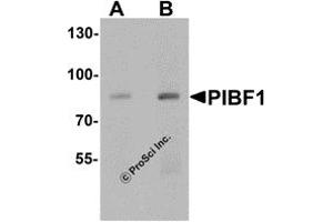 Western Blotting (WB) image for anti-Progesterone Immunomodulatory Binding Factor 1 (PIBF1) (C-Term) antibody (ABIN1077444) (PIBF1 anticorps  (C-Term))