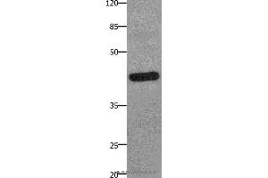 Western blot analysis of A549 cell, using PTGER2 Polyclonal Antibody at dilution of 1:100 (PTGER2 anticorps)