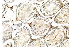 ABIN6259219 and ABIN6274143 at 1/100 staining Rat testis tissue by IHC-P.