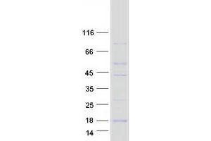 Validation with Western Blot