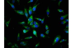 Immunofluorescence staining of Hela cells with ABIN7174056 at 1:144, counter-stained with DAPI.