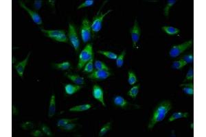 Immunofluorescence staining of Hela cells with ABIN7174056 at 1:144, counter-stained with DAPI.