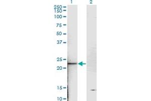 Western Blot analysis of TNNI2 expression in transfected 293T cell line by TNNI2 monoclonal antibody (M05), clone 2D5. (TNNI2 anticorps  (AA 2-100))