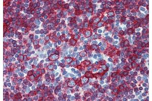 Immunohistochemistry staining of human small intestine (paraffin-embedded sections) with anti-HLA-DR+DP (HL-38). (HLA-DP/DR anticorps)