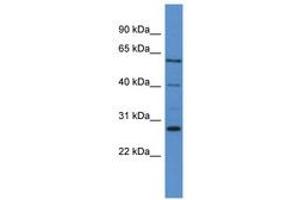 Image no. 1 for anti-Cytochrome P450, Family 24, Subfamily A, Polypeptide 1 (CYP24A1) (AA 263-312) antibody (ABIN6746768)