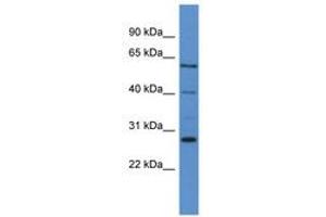 Image no. 1 for anti-Cytochrome P450, Family 24, Subfamily A, Polypeptide 1 (CYP24A1) (AA 263-312) antibody (ABIN6746768) (CYP24A1 anticorps  (AA 263-312))