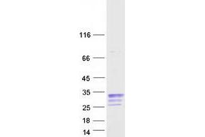 Validation with Western Blot