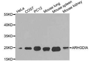Western blot analysis of extracts of various cell lines, using ARHGDIA antibody.