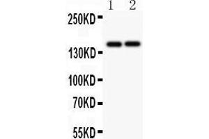 Anti-CD45 Picoband antibody,  All lanes: Anti CD45  at 0.
