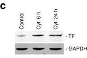 Cytokines induce TF expression in human islets and MIN-6 cells.