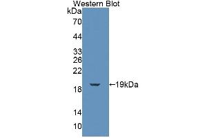 Figure. (FKBP2 anticorps  (AA 1-142))