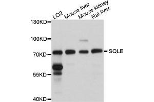 Western blot analysis of extracts of various cells, using SQLE antibody. (SQLE anticorps)