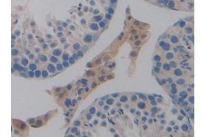 Detection of PDL1 in Mouse Testis Tissue using Polyclonal Antibody to Programmed Cell Death Protein 1 Ligand 1 (PDL1)