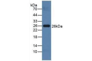 Figure. (PRSS2 anticorps  (AA 29-240))