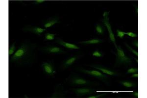 Immunofluorescence of monoclonal antibody to DMC1 on HeLa cell.
