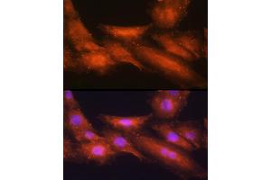 Immunofluorescence analysis of H9C2 cells using [KO Validated] HINT1 Rabbit pAb  at dilution of 1:100 (40x lens).