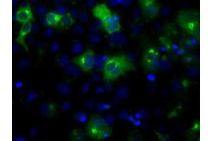 Anti-LIPG mouse monoclonal antibody (ABIN2453248) immunofluorescent staining of COS7 cells transiently transfected by pCMV6-ENTRY LIPG (RC209248). (LIPG anticorps)